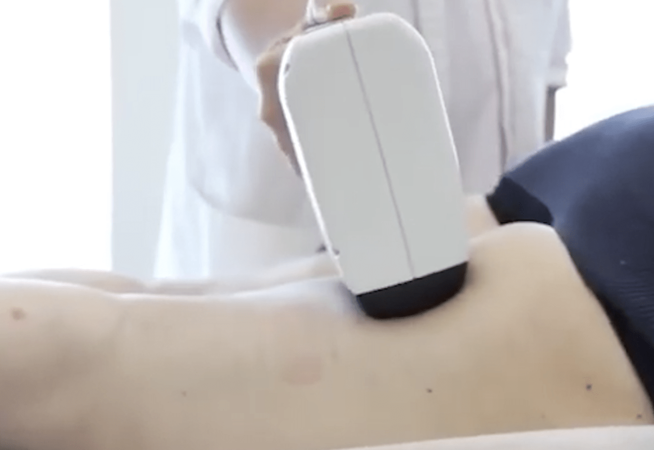 Inmode Forma Inmode Forma